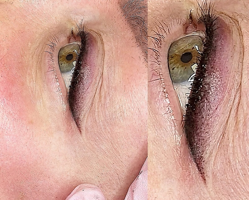 Allure permanent makeup result 1