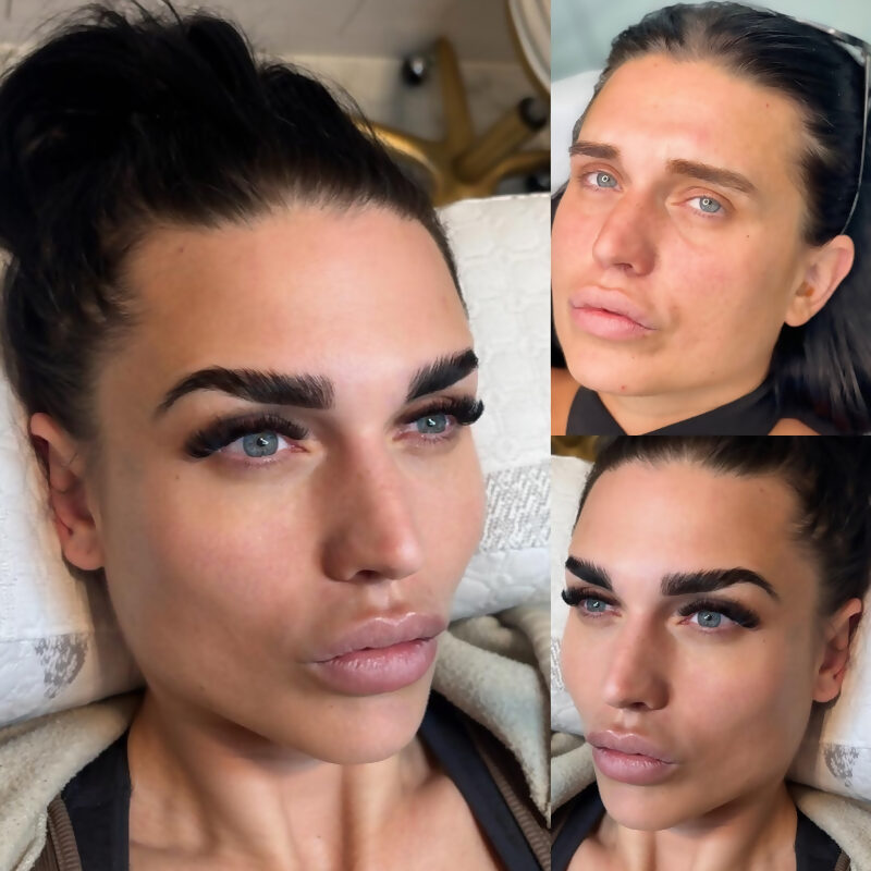 Allure permanent makeup result 20
