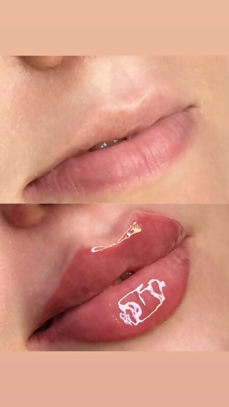 Allure permanent makeup result 26