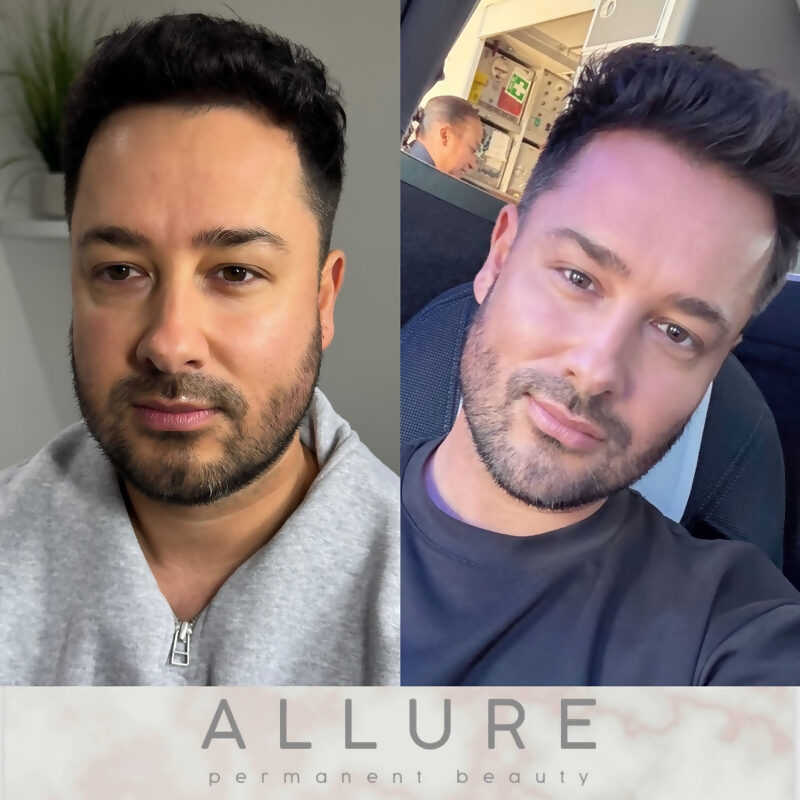 Allure permanent makeup result 30