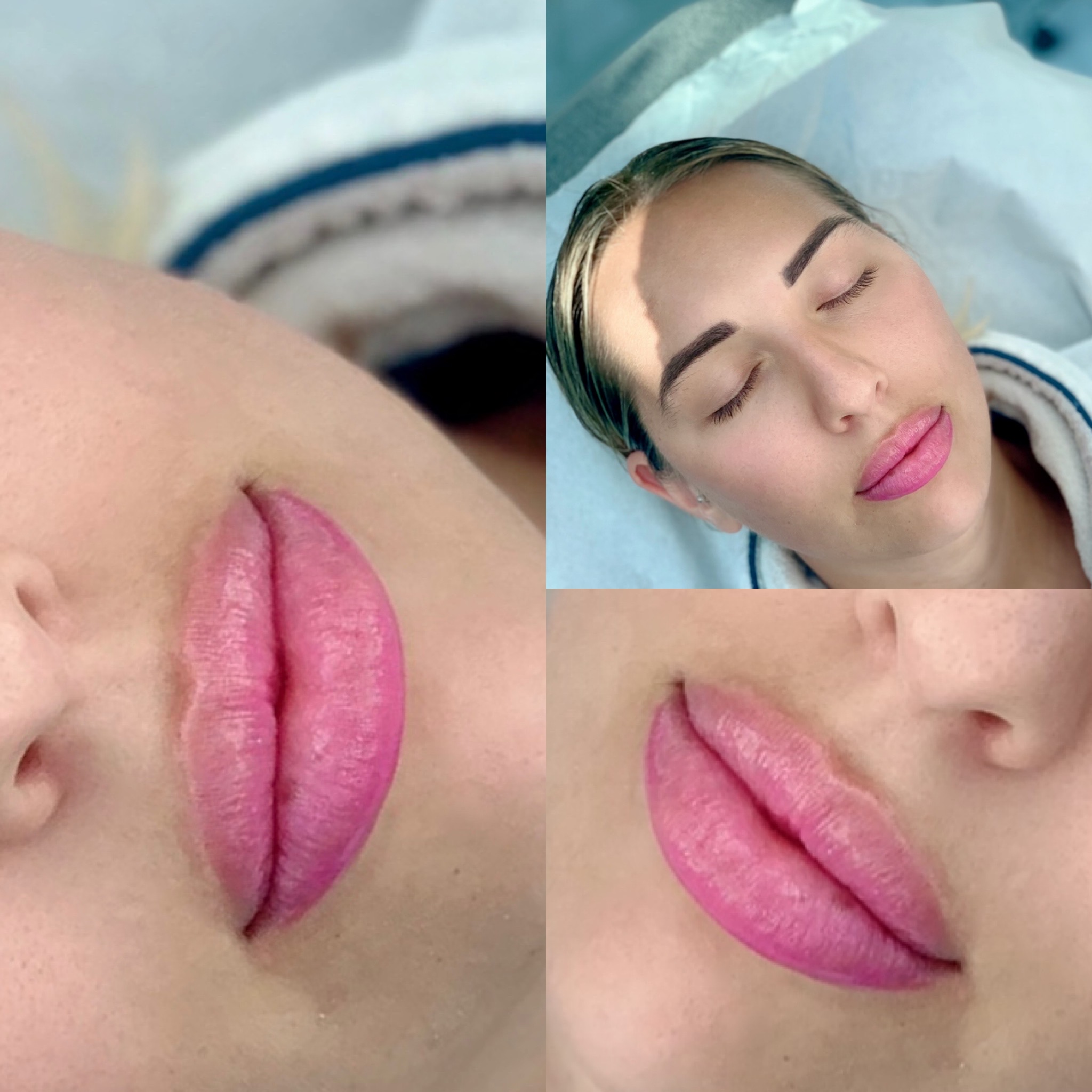 Lips gallery 1