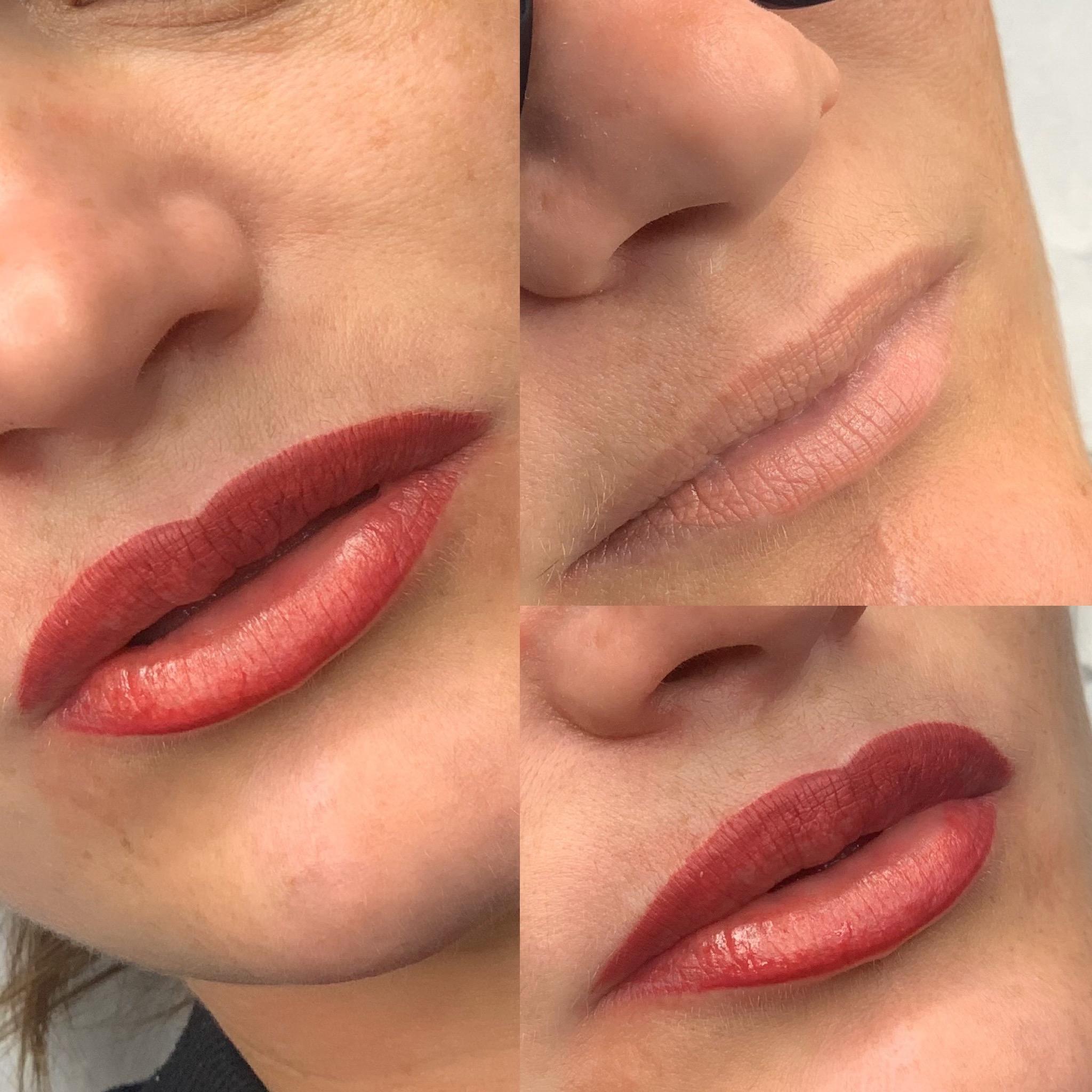 Lips gallery 2