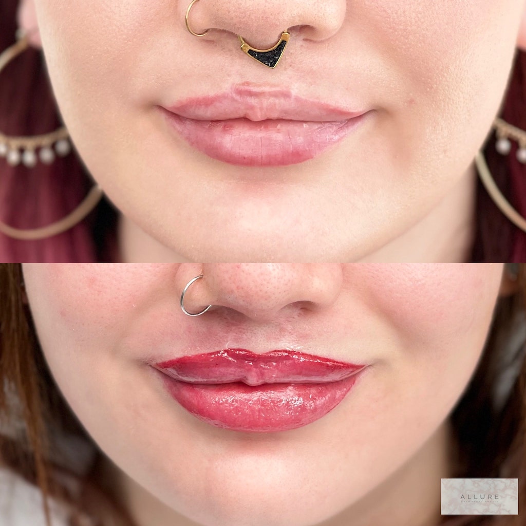 Medica lip blush min